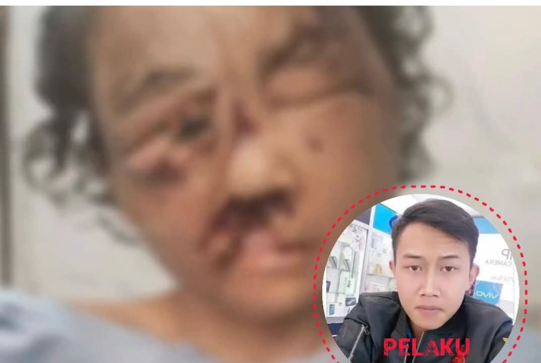 Tiga Tahun Disekap Pacar, Seorang Perempuan di Bandung Ditemukan dalam Kondisi Tragis IMG-20260622-WA0014.jpg